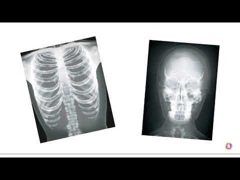 True To Life Human X-Rays