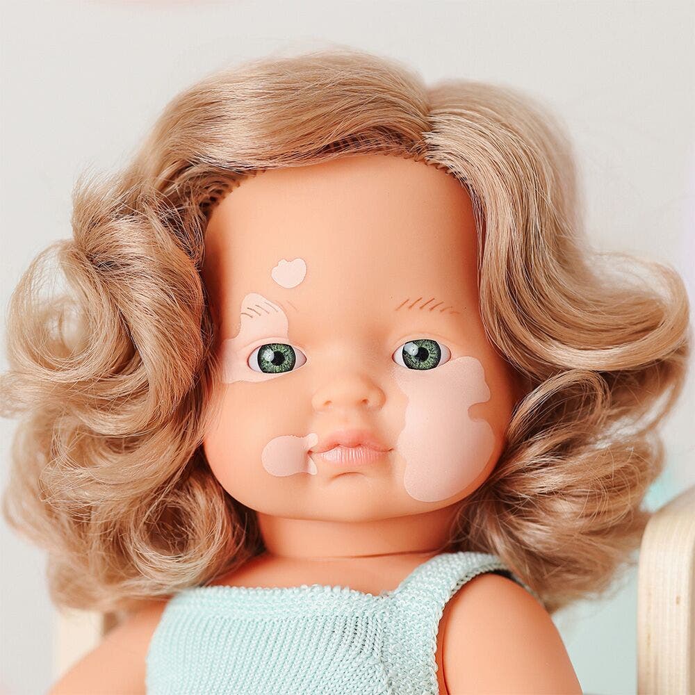 Baby Doll Caucasian Girl with Vitiligo 15in