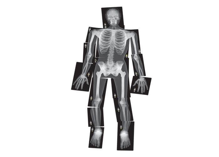 True To Life Human X-Rays