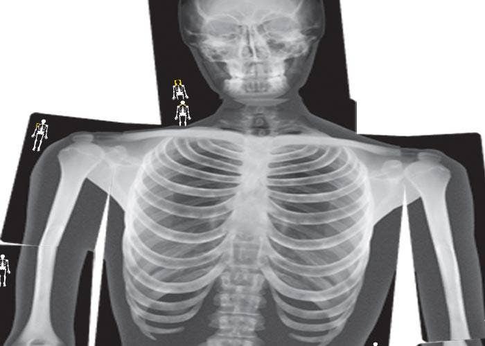 True To Life Human X-Rays