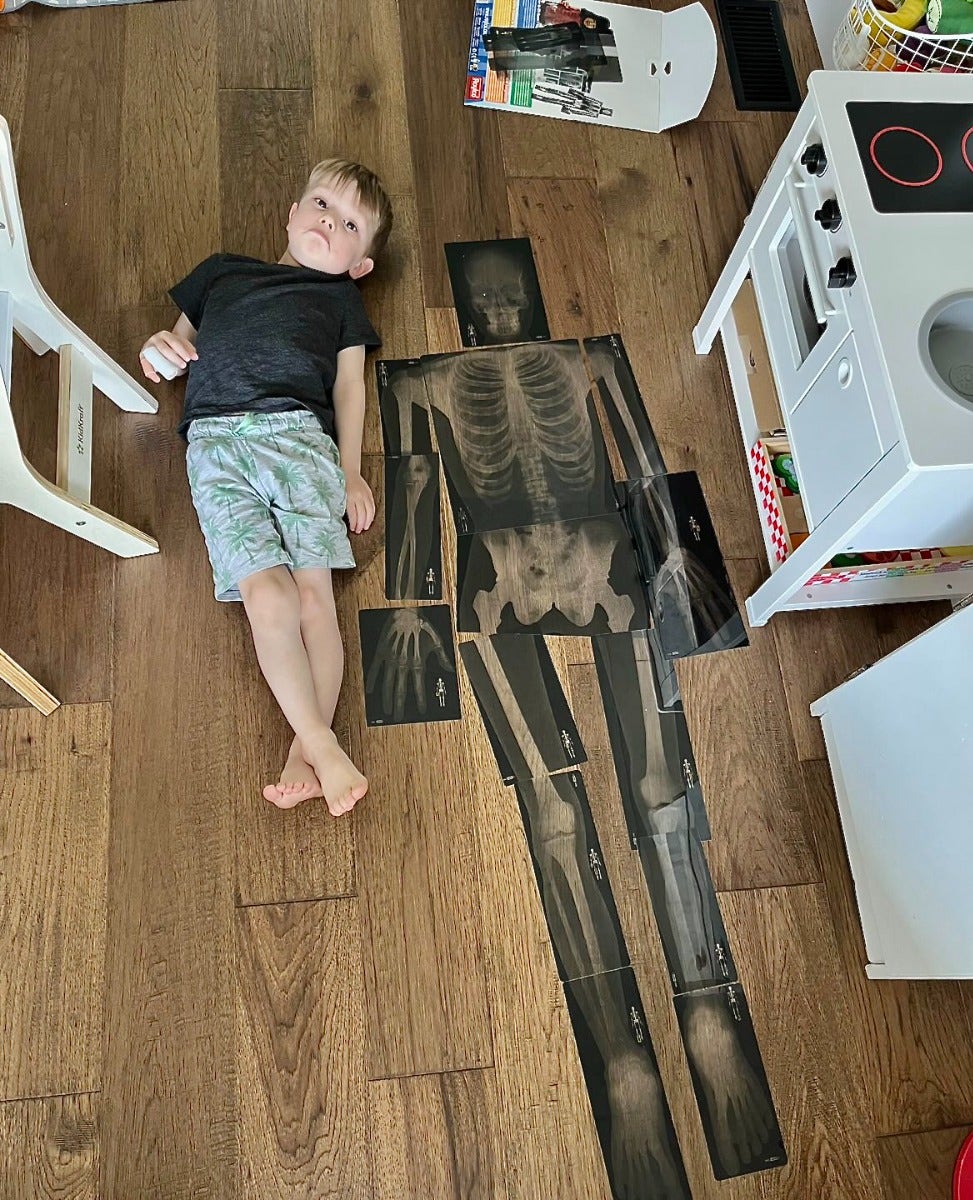 True To Life Human X-Rays